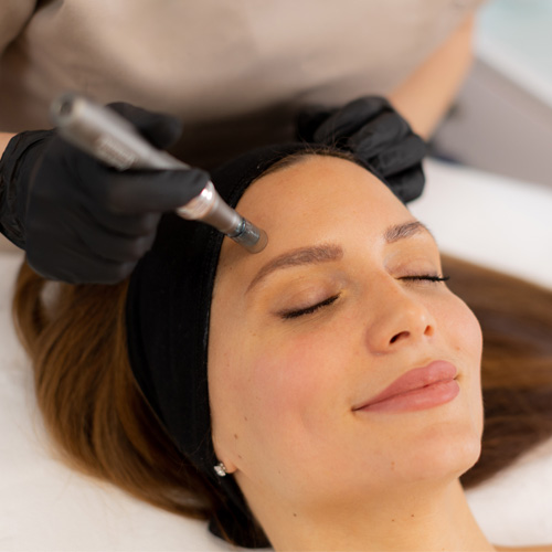 needling